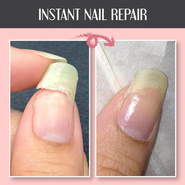 NAIL REPAIR PROTECTION GEL