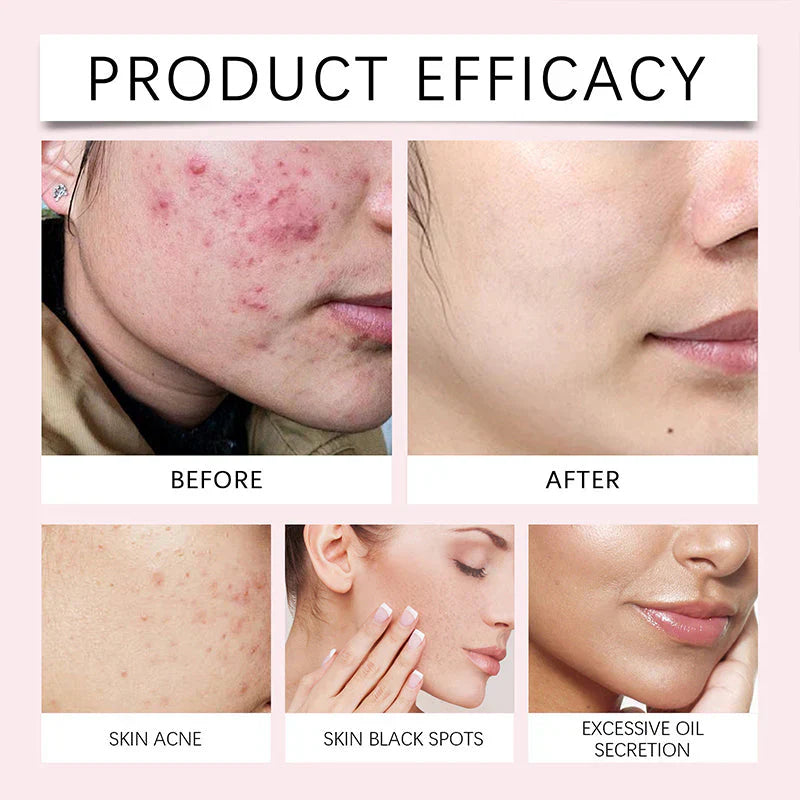 Turmeric and Kojic Acid Pads for Face