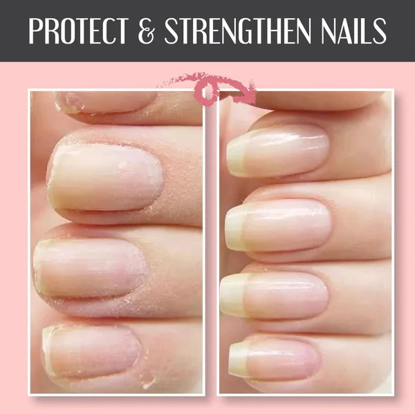 NAIL REPAIR PROTECTION GEL